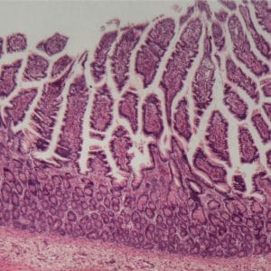 Microscope of large intestine inflammation